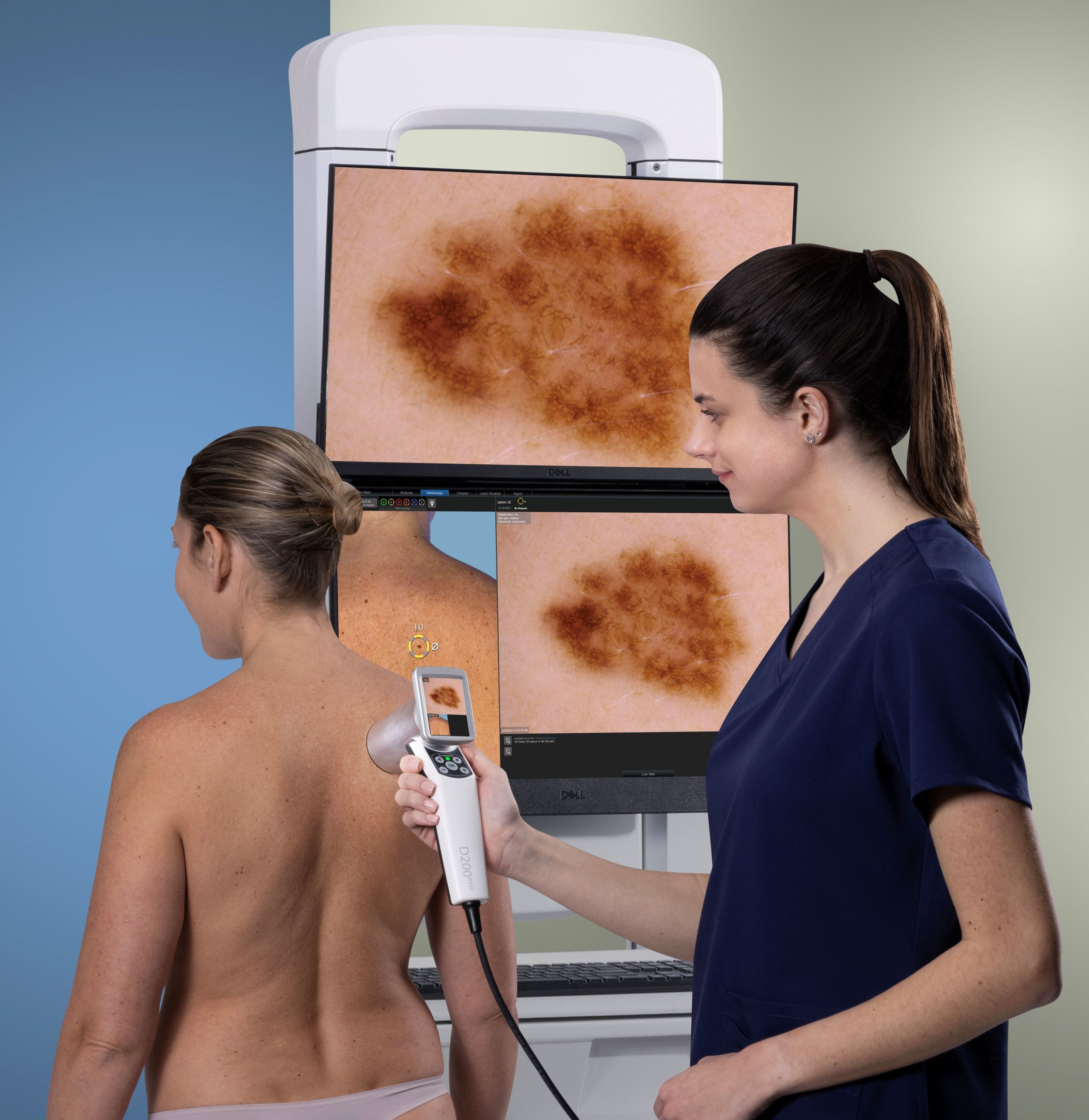 IntelliStudio DermaGraphix - IntelliStudio Generation 3 - D200 Derm Exam (Full Resolution) crop