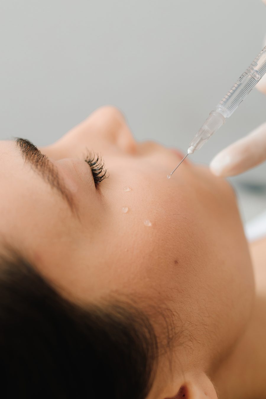 Skinbooster-behandeling bij Dermatologie Oostkamp